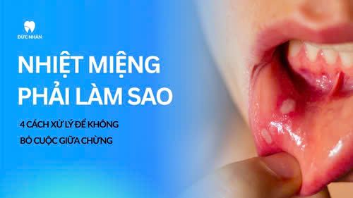 Nhiệt miệng khi niềng răng phải làm sao? 4 Cách xử lý để không bỏ cuộc giữa chừng